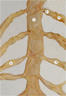 Intrathecal Drug Delivery: Advances and Applications in the Management of Chronic Pain Patient